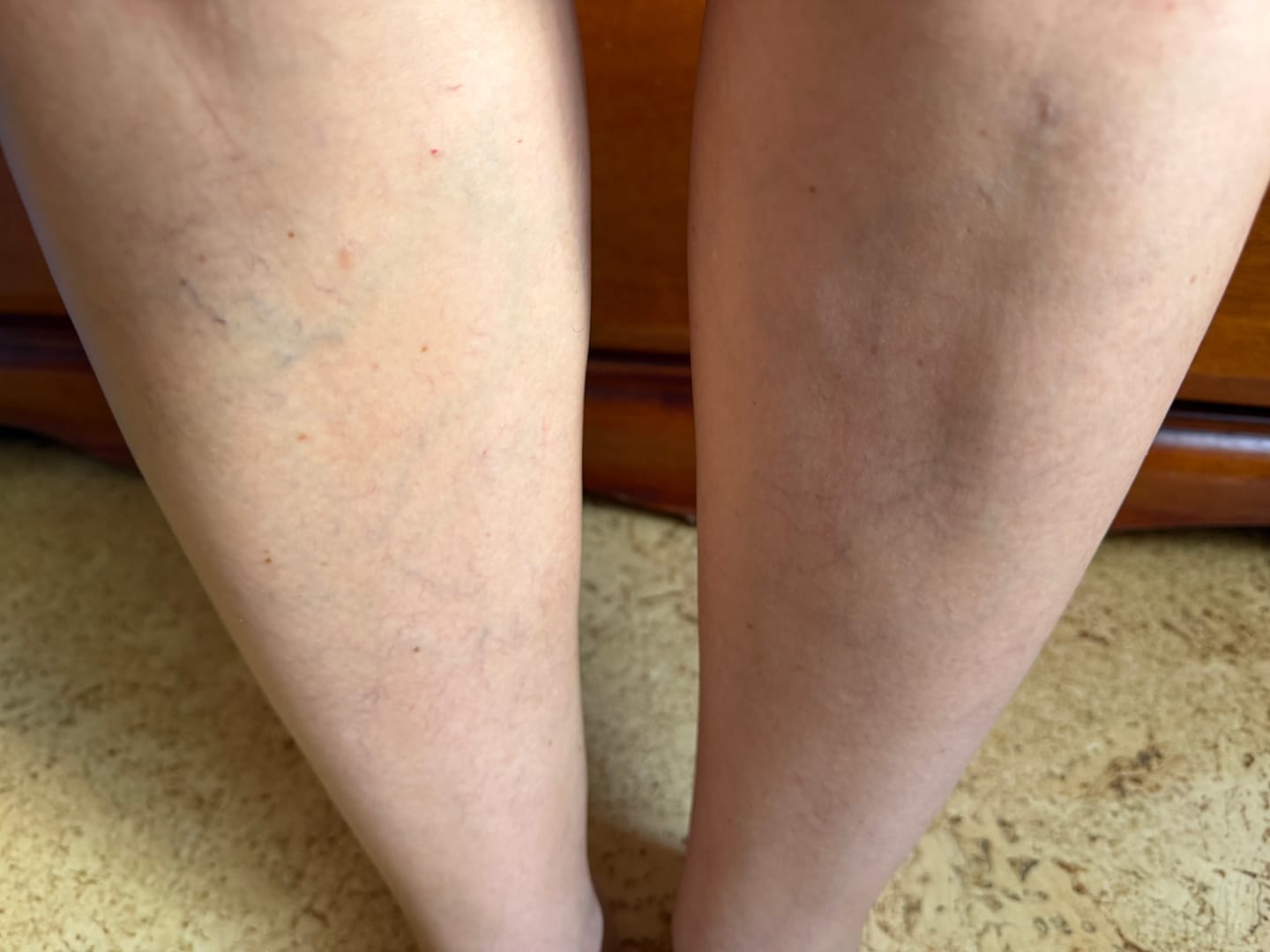 Customer photo review of Perfektor do Ciała
