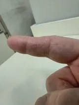 Customer photo review of Crema natural MANÚ™ Anti Eczema 100g