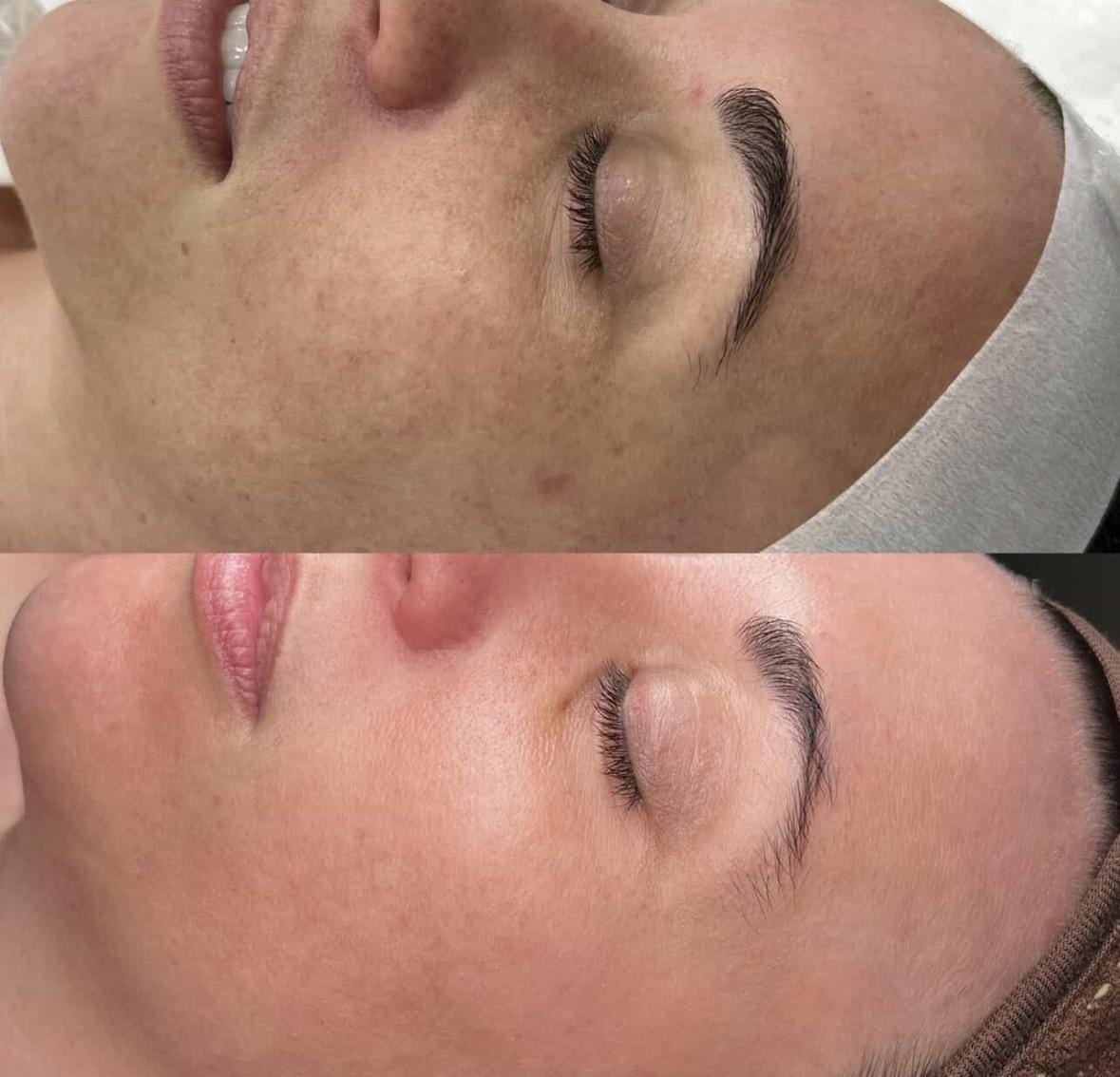 Customer photo review of Trudermal Glow LED Face