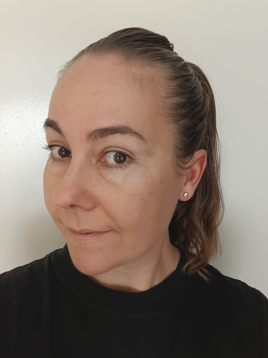 Customer photo review of Ceramide + Caffeine Ageless Eye Serum