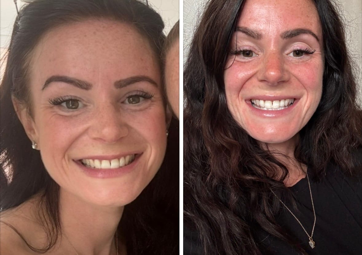 Customer photo review of Botanis | Conservá tus dientes por más tiempo