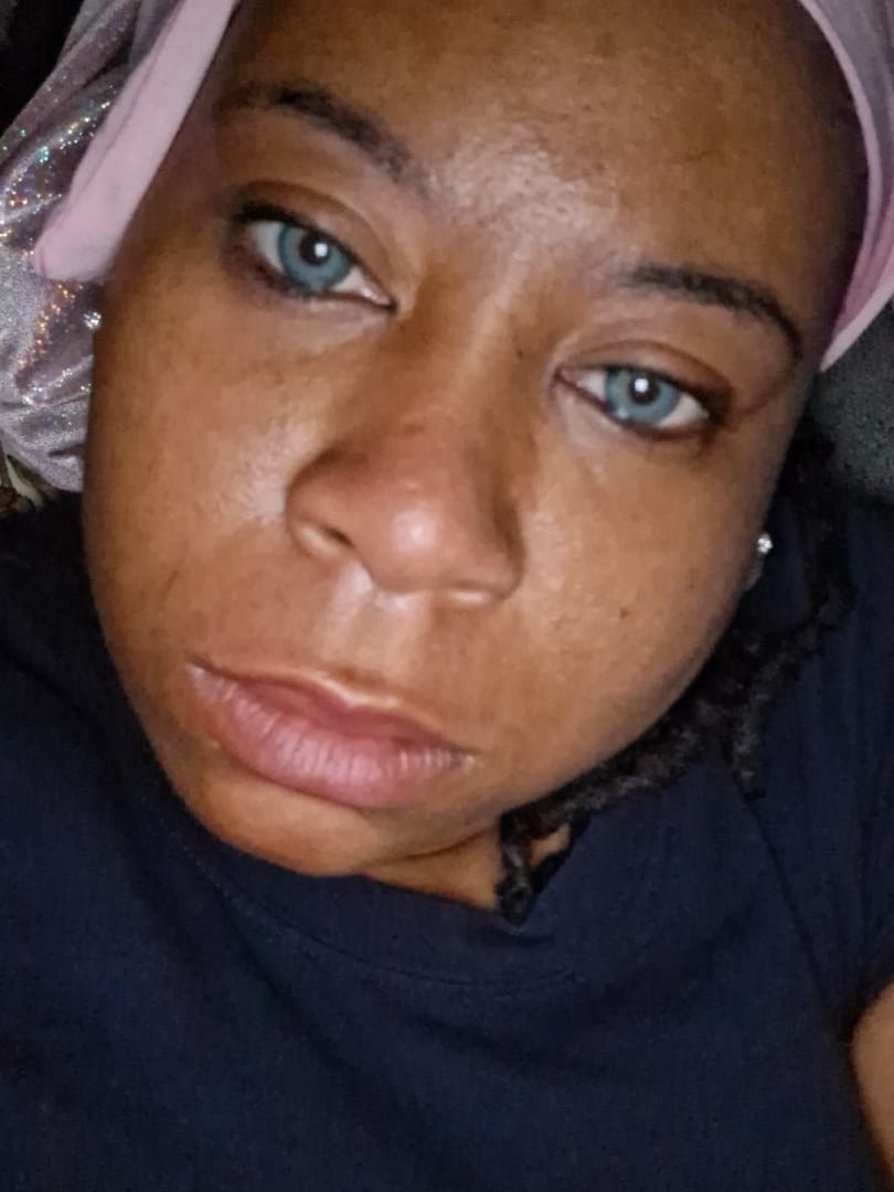 Customer photo review of Himalaya Blue Prescription Colored Contact Lenses