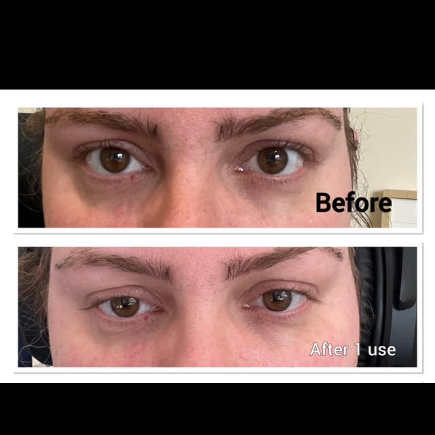Customer photo review of Ceramide + Caffeine Ageless Eye Serum