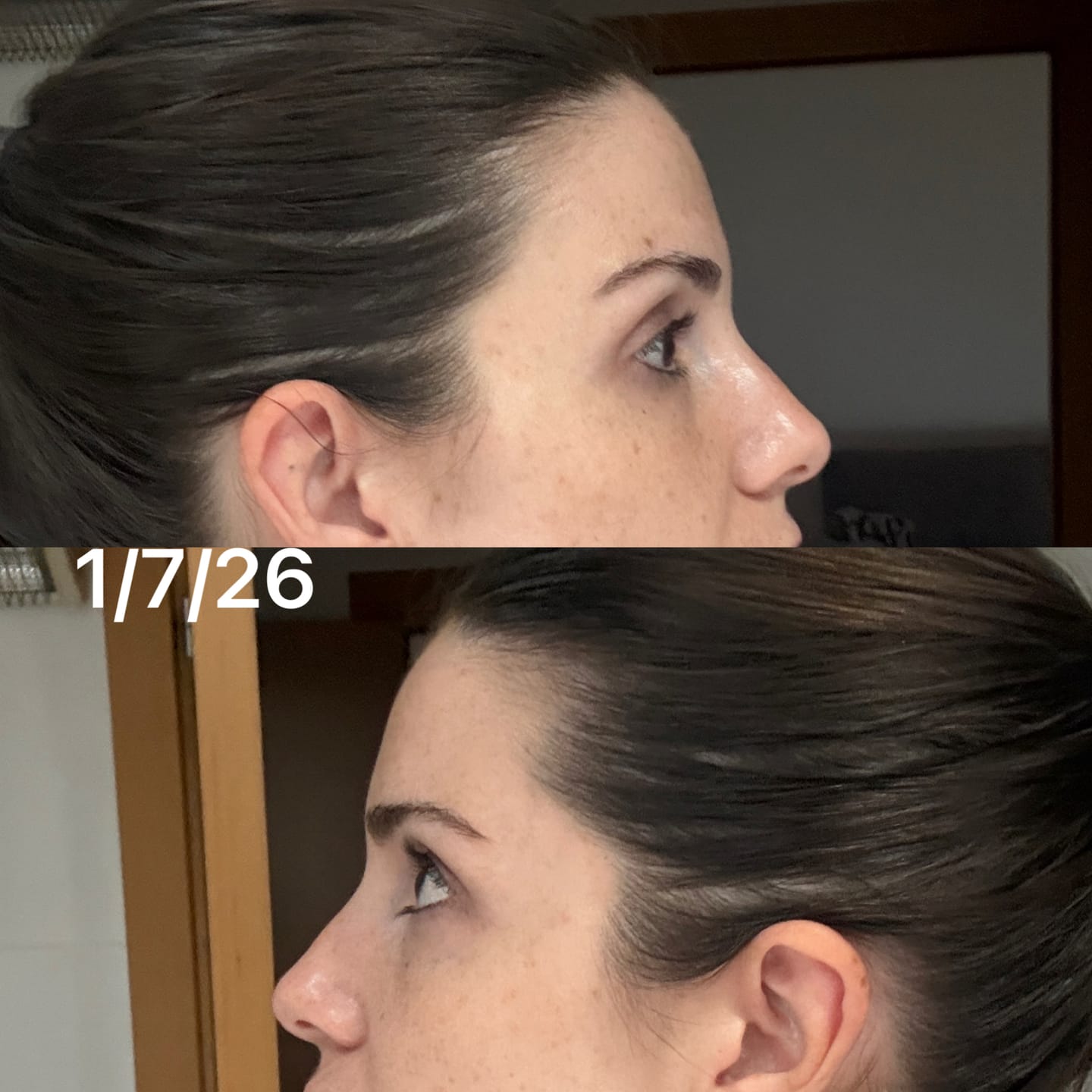 Customer photo review of KosmaHair Sérum | Restaurador Capilar & Entradas