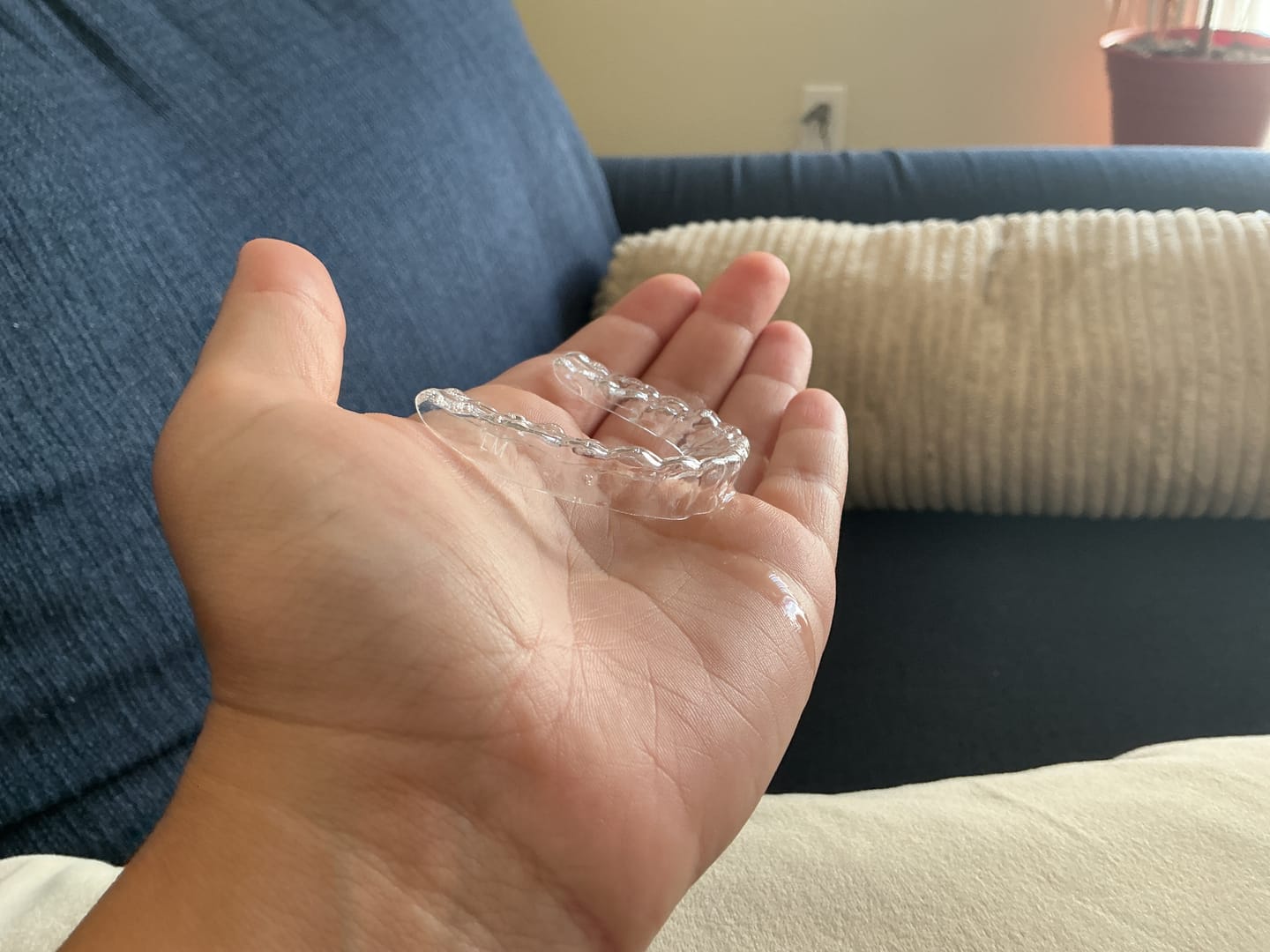 Customer photo review of Lower Teeth Retainer