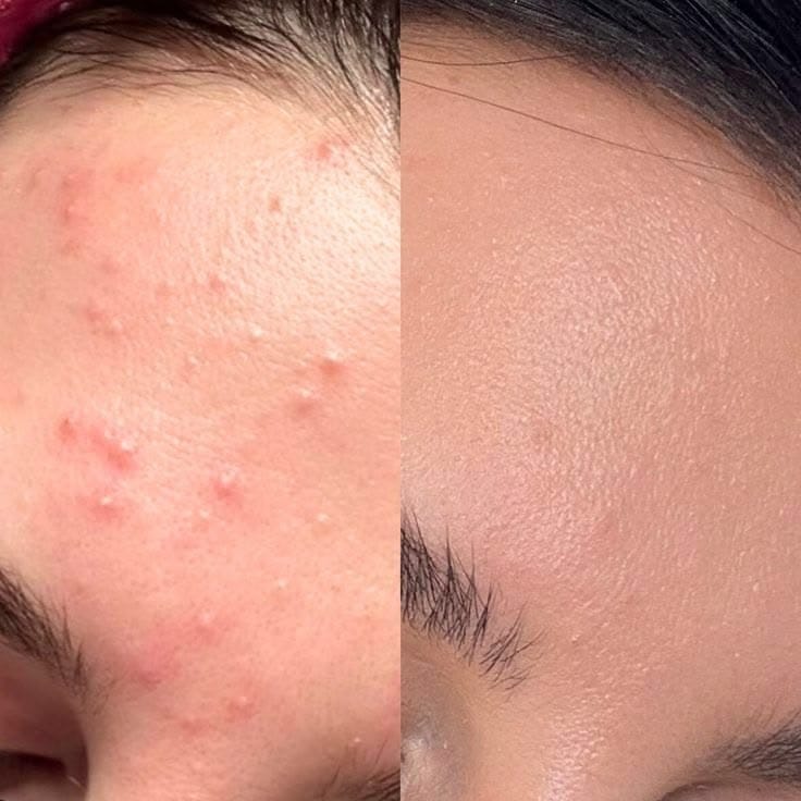 Customer photo review of 32 Day Hair Growth Challenge Bundle