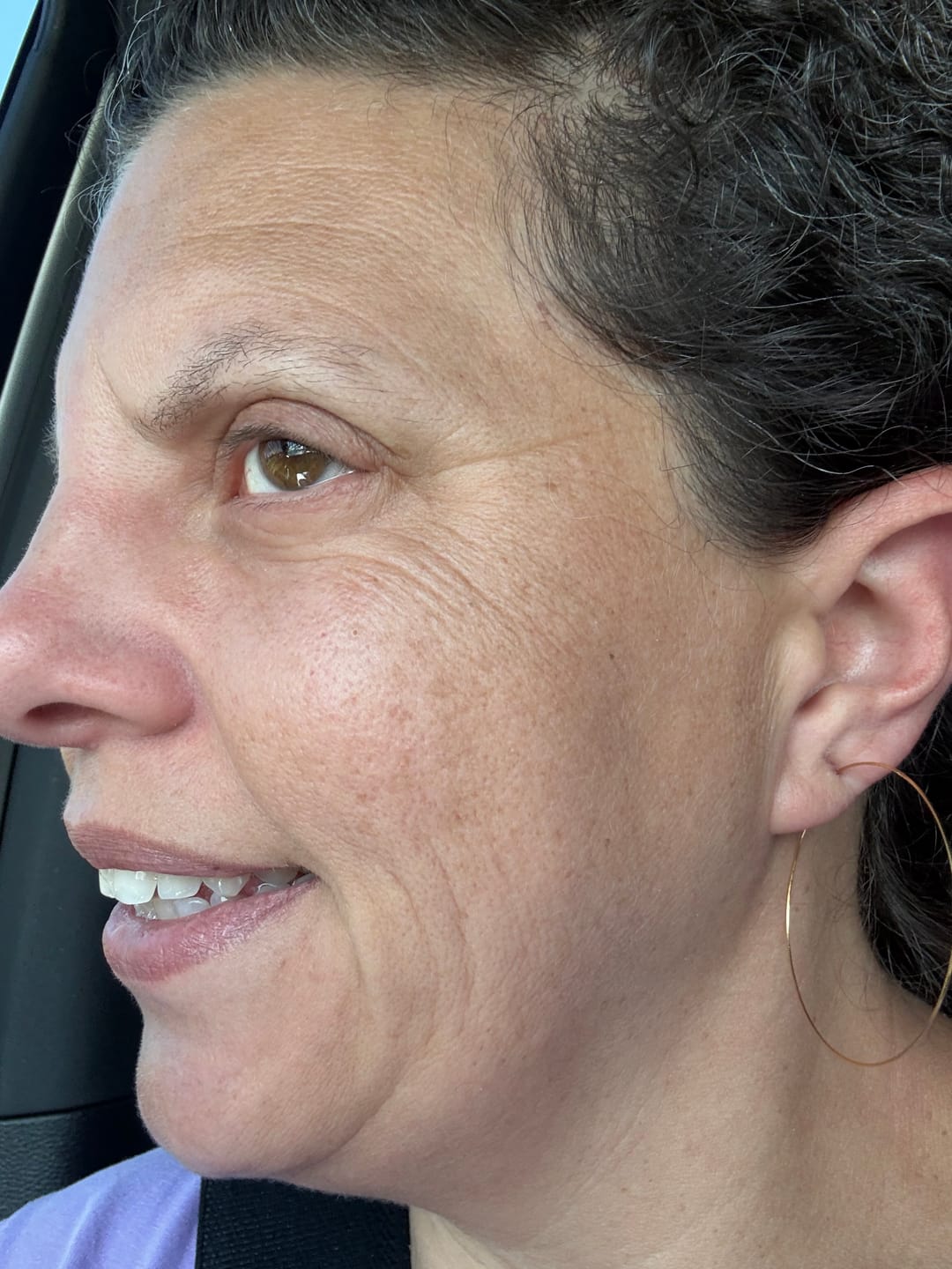 Customer photo review of Gold Hoop Dangles Hypoallergenic Earrings for Sensitive Ears with Plastic Posts