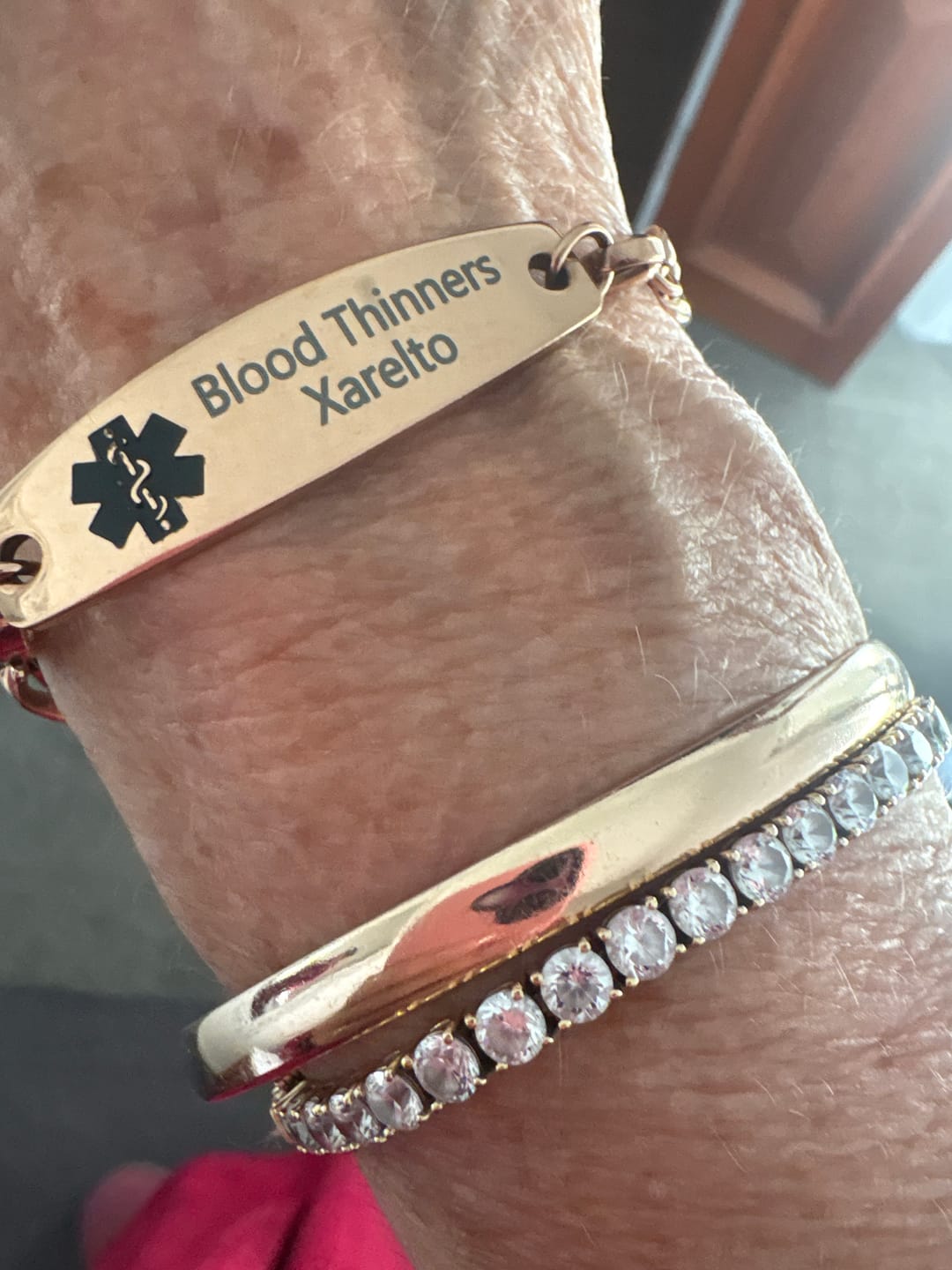Customer photo review of Classic Rose Gold Medical Alert ID Chain Bracelet