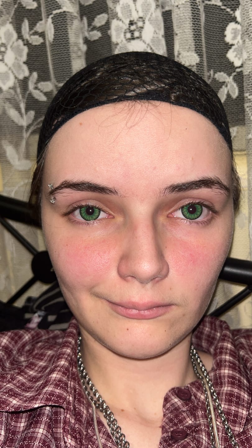 Customer photo review of Vega Bright Forest Green Prescription Colored Contact Lenses