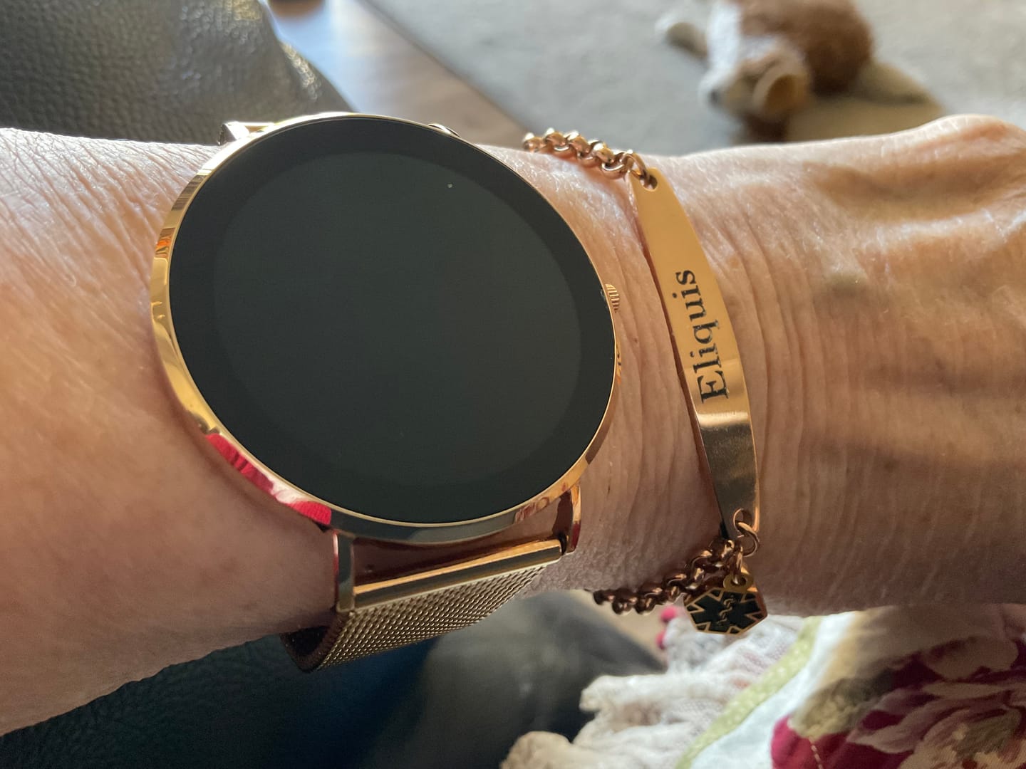Customer photo review of Rose Gold Colour Medical Alert Bracelet with Medical Charm