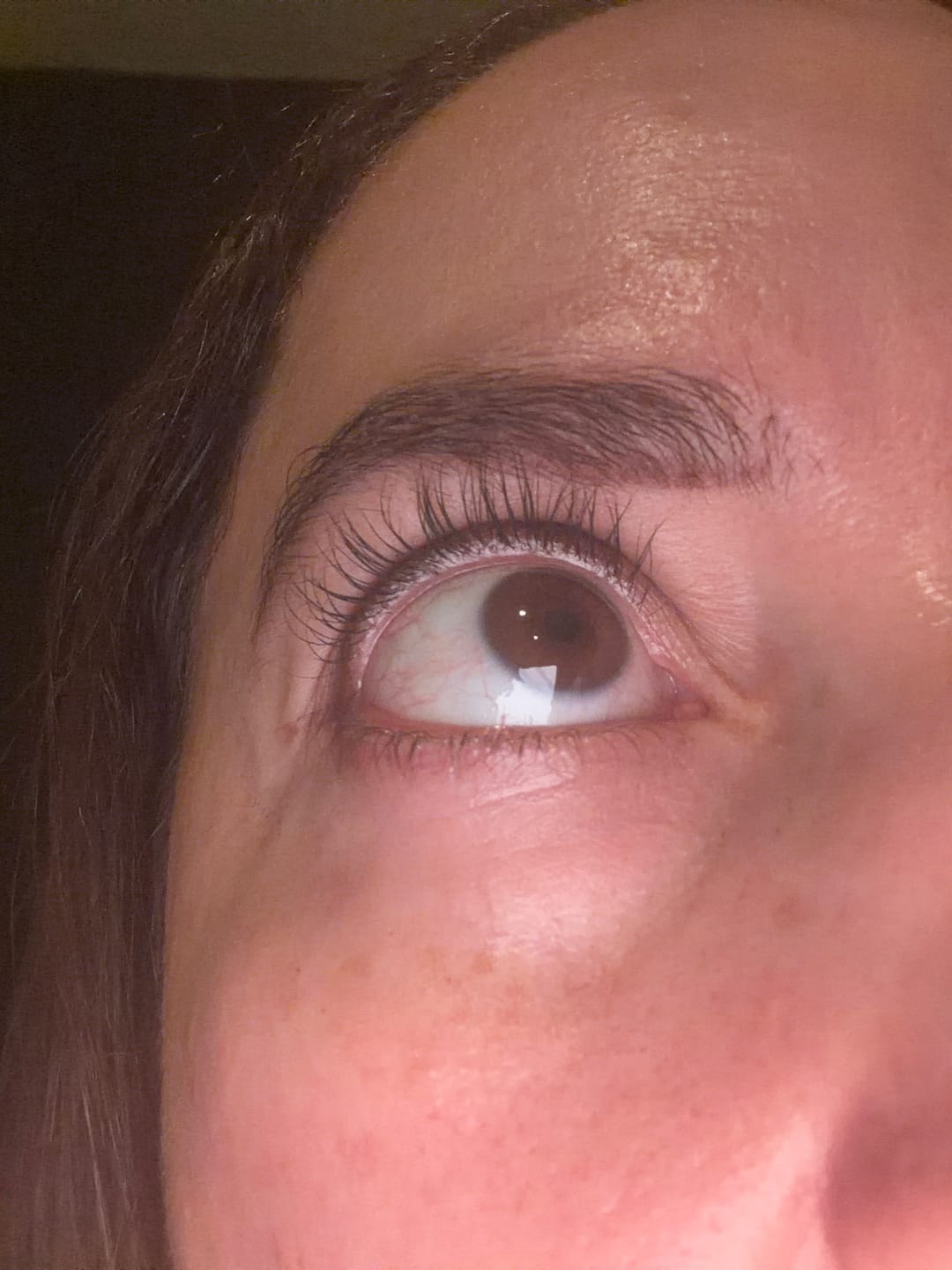Customer photo review of 360º Shot PDRN lifting Eye cream