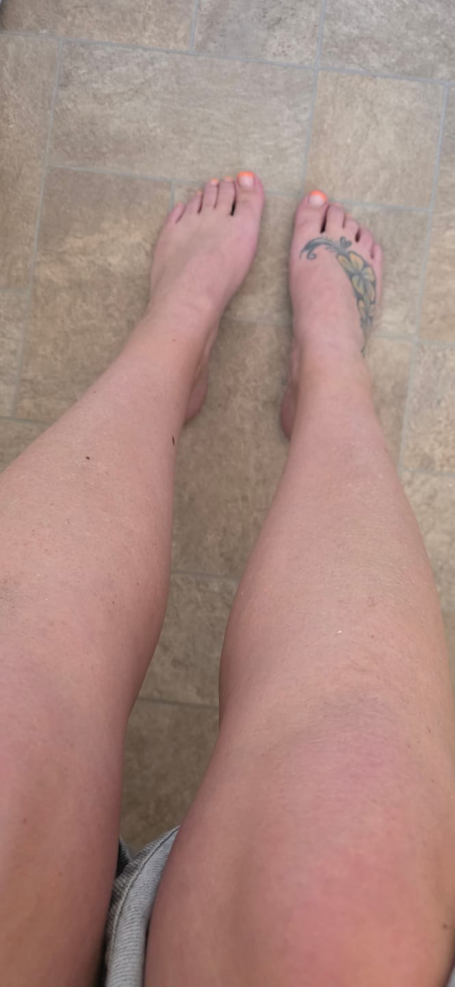 Customer photo review of Self Tanning | 150 Capsules
