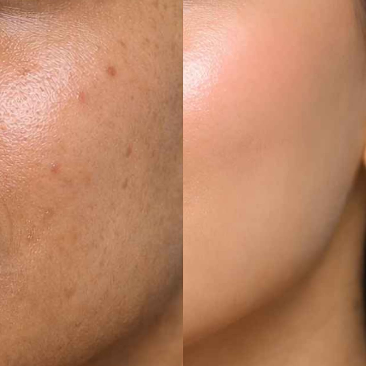 Customer photo review of Skin Rescue Mist