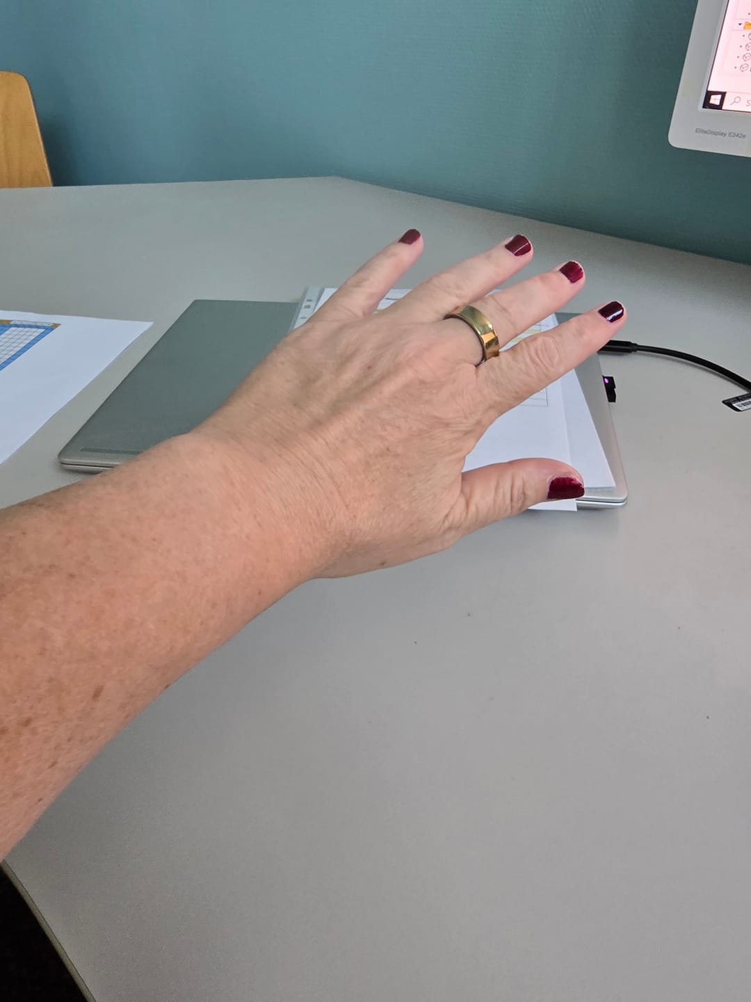 Customer photo review of SMART RING ONE