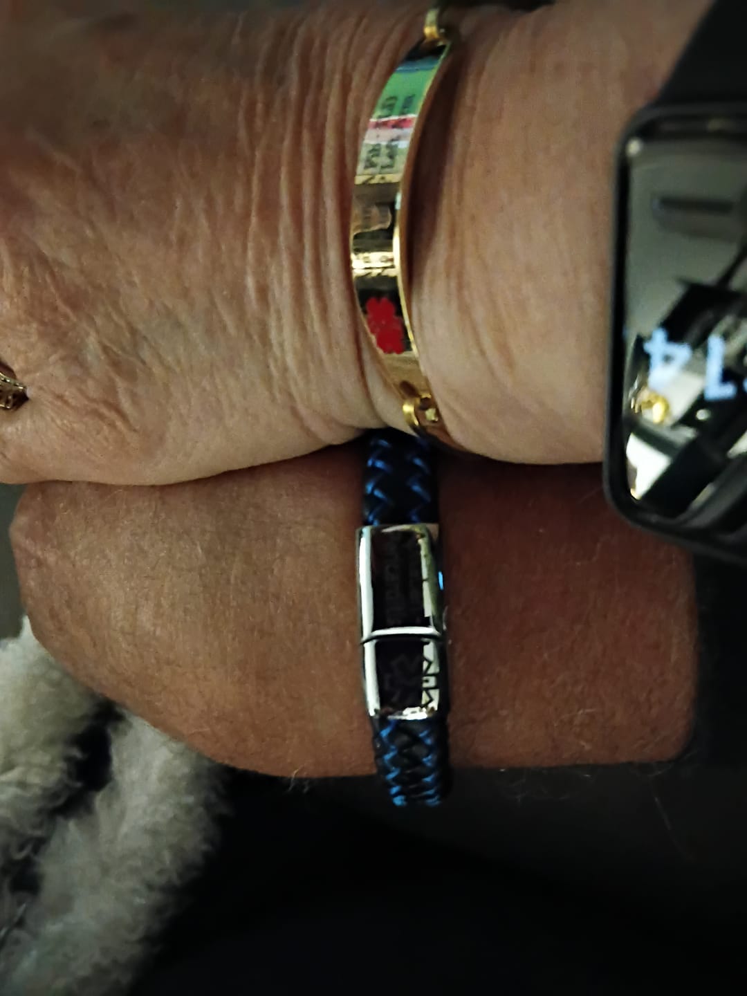 Customer photo review of SafeChic Braided Leather Medical ID Bracelet