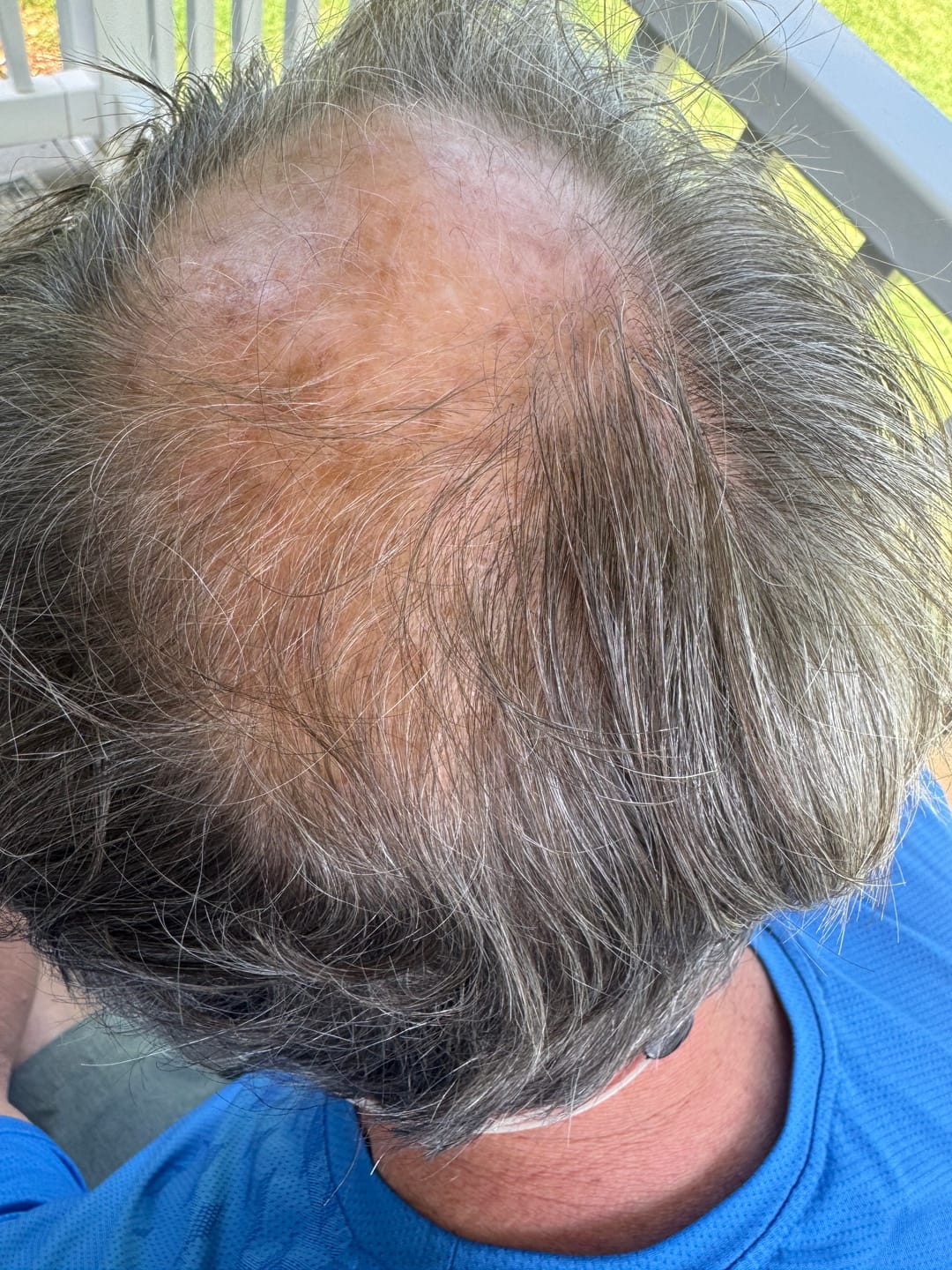 Customer photo review of Spartan™ Root Activator Shampoo 3 Bottles(sc)