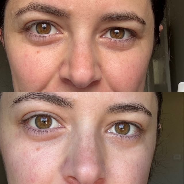 Customer photo review of Ceramide + Caffeine Ageless Eye Serum