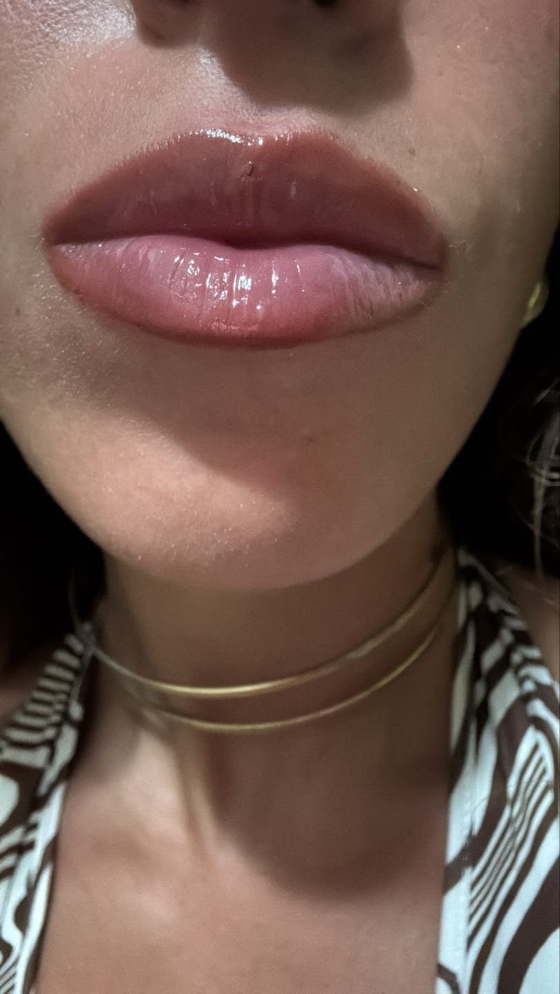 Customer photo review of Fatal Lip Plumper