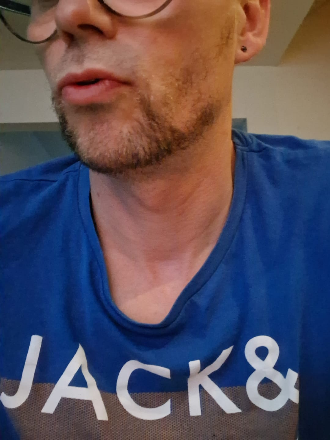 Customer photo review of Activateur de Barbe | Croissance Zones Clairsemées