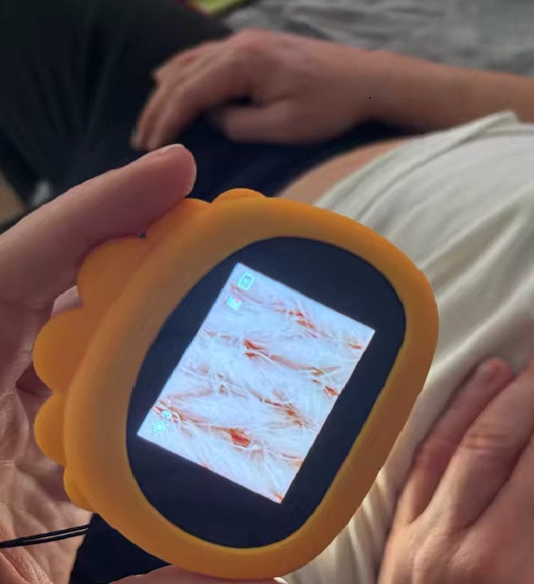 Customer photo review of Kit Explorador: Microscopio Infantil Portable Digital HD + Guía de Crianza Digital 🔬✨