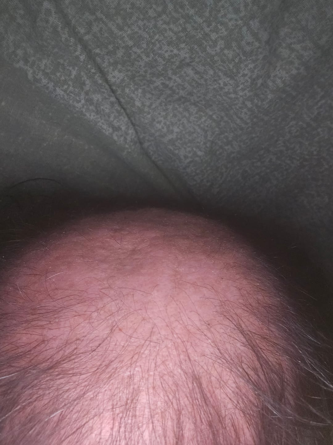 Customer photo review of Kit Anti-Chute Cheveux Homme | Odin - Max Barber