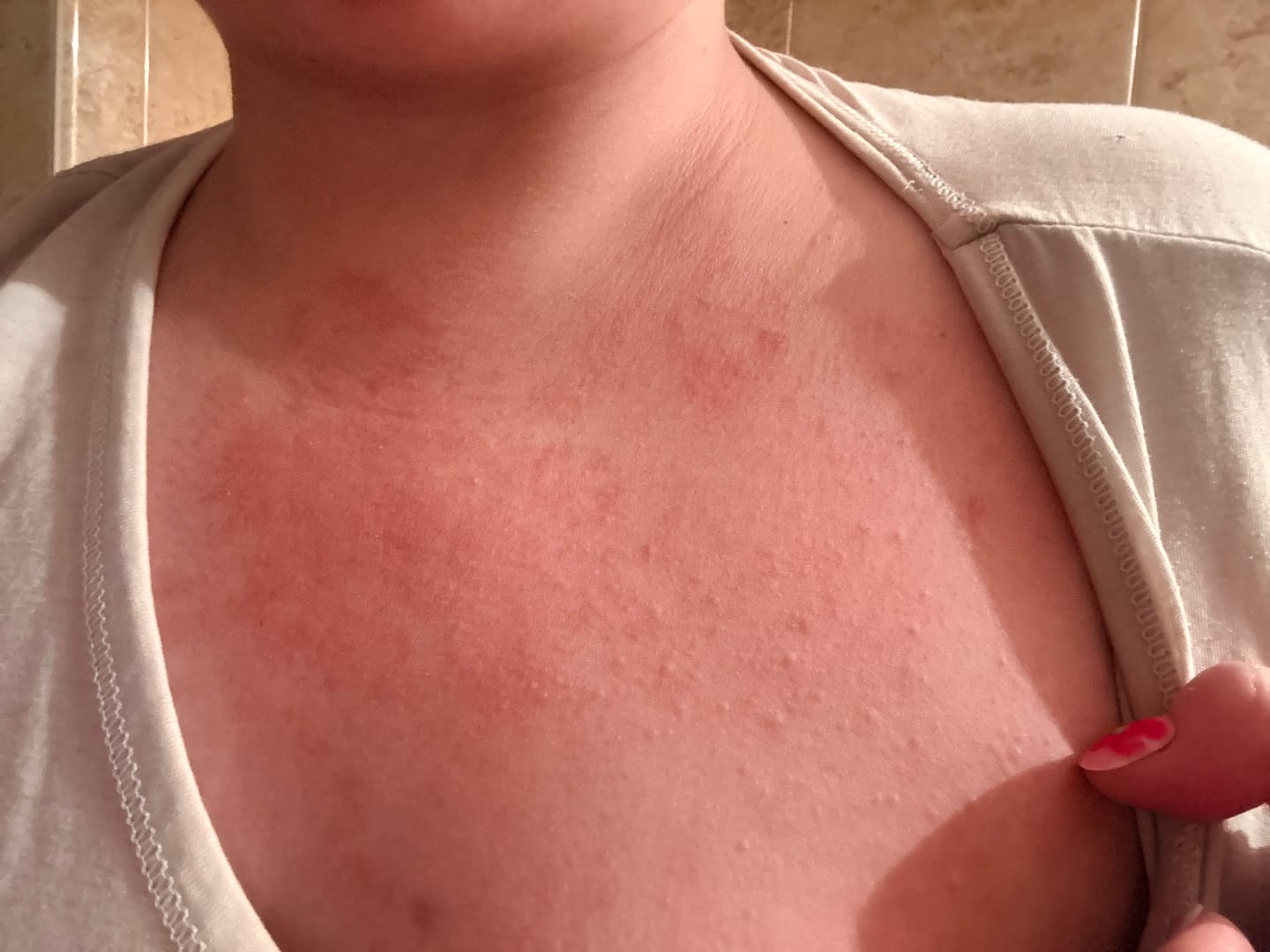 Customer photo review of Carotone Clarifying Cream Jar | Radiant Skin Care