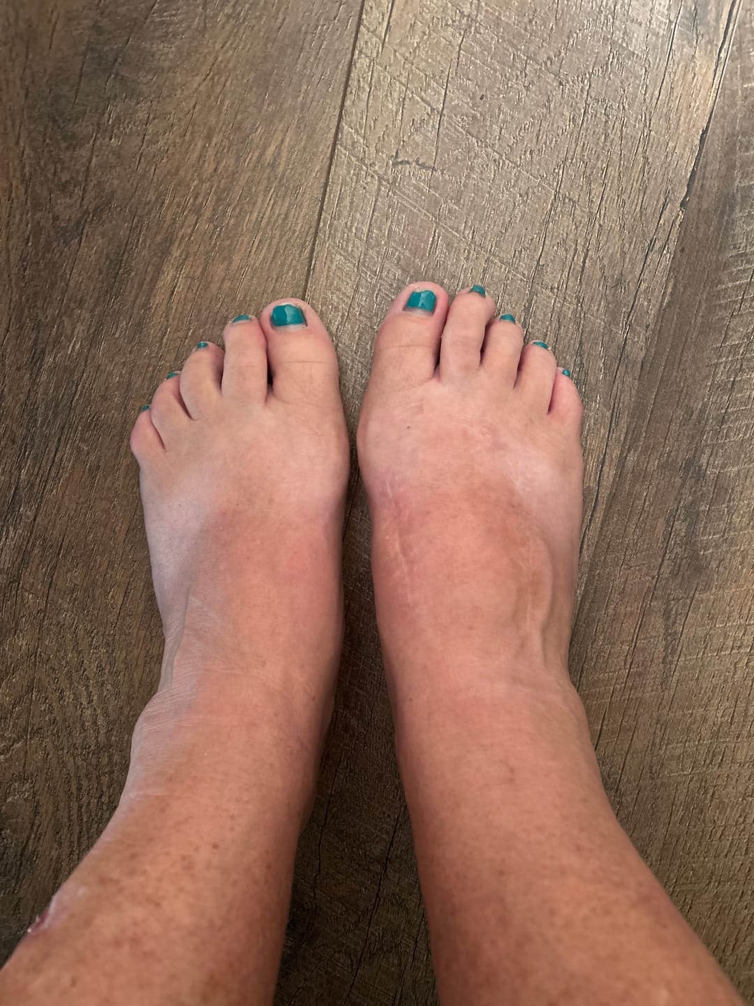 Customer photo review of OptiWize Collagen +Plus Human Supplement for Joint Health