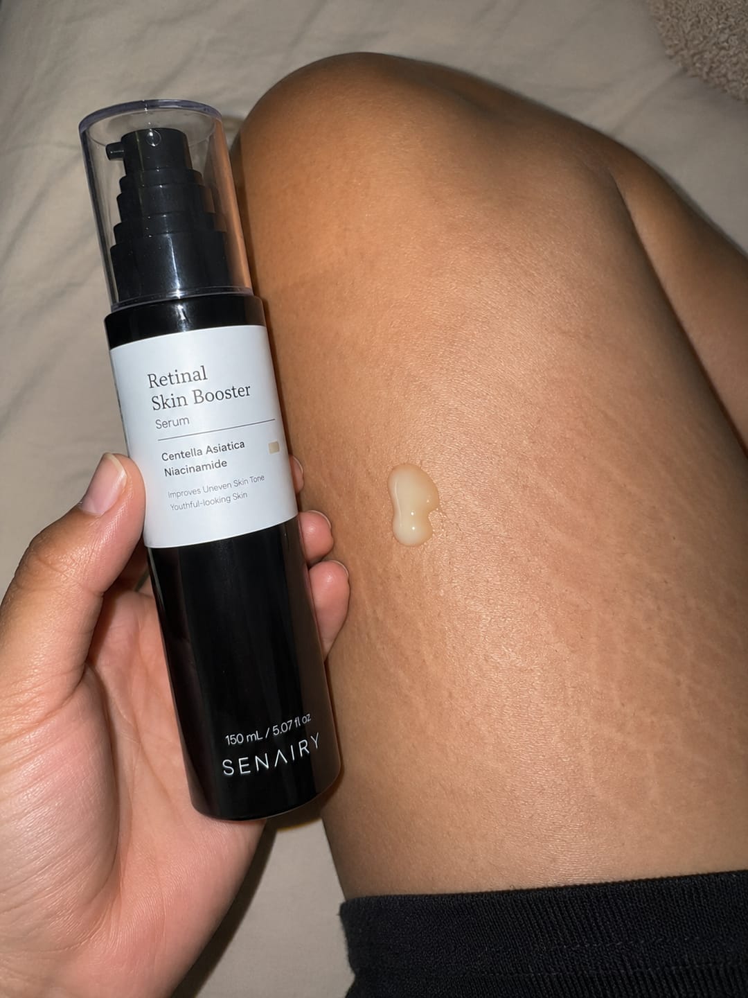 Customer photo review of Senairy Retinal Stretch Mark Serum