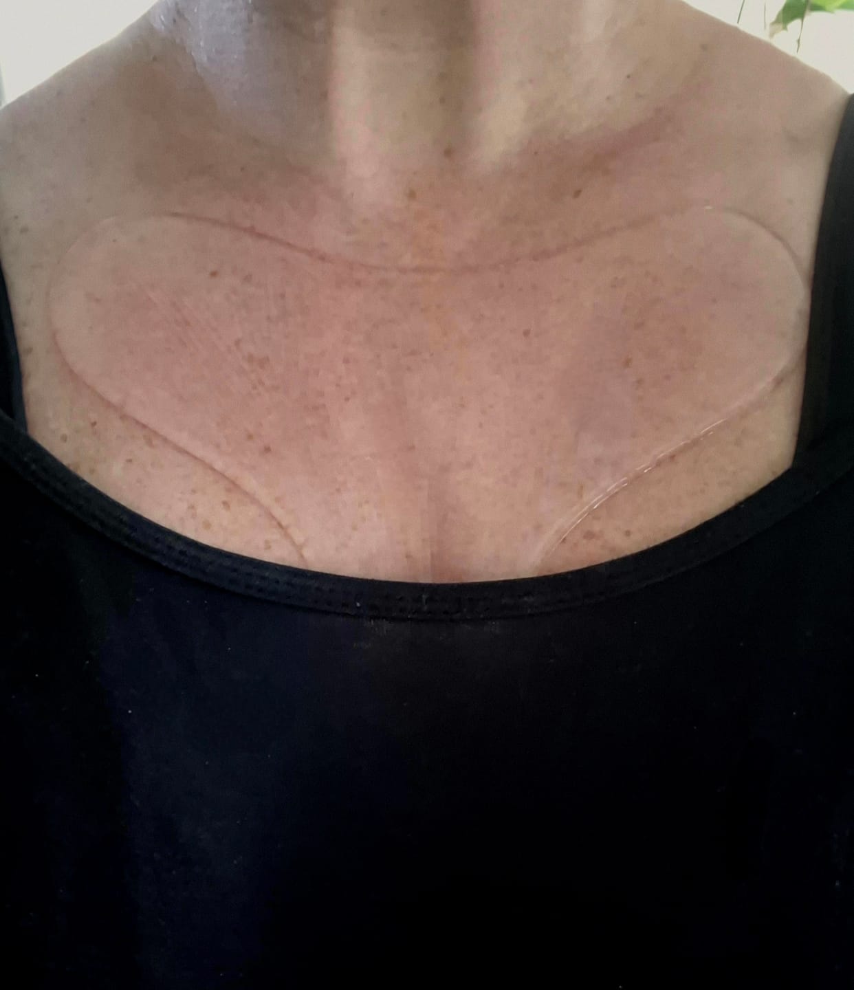 Customer photo review of Dekolleté Anti-Falten Maske