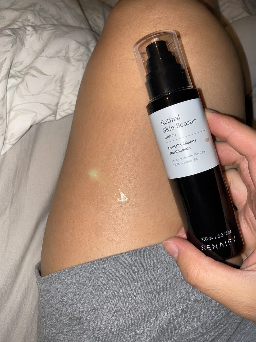 Customer photo review of Senairy Retinal Stretch Mark Serum