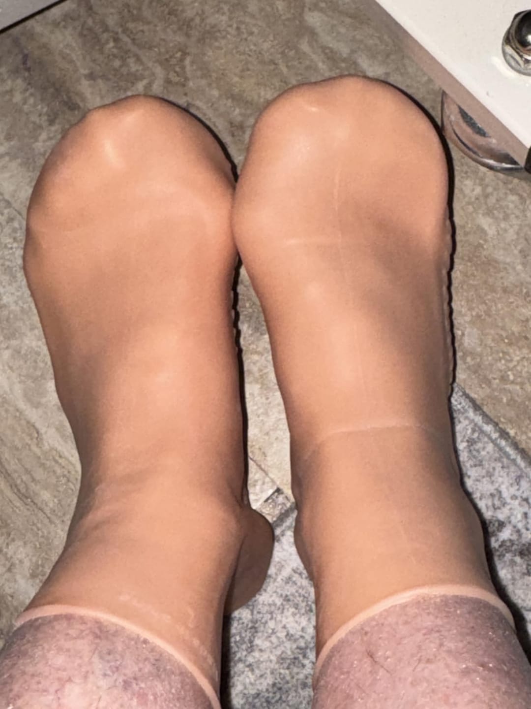 Customer photo review of Kit de Cuidado para Pies 3 en 1