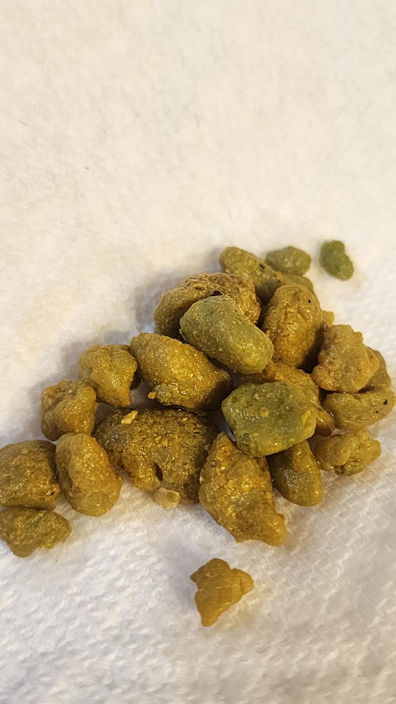Customer photo review of 10-Day Liver Cleanse