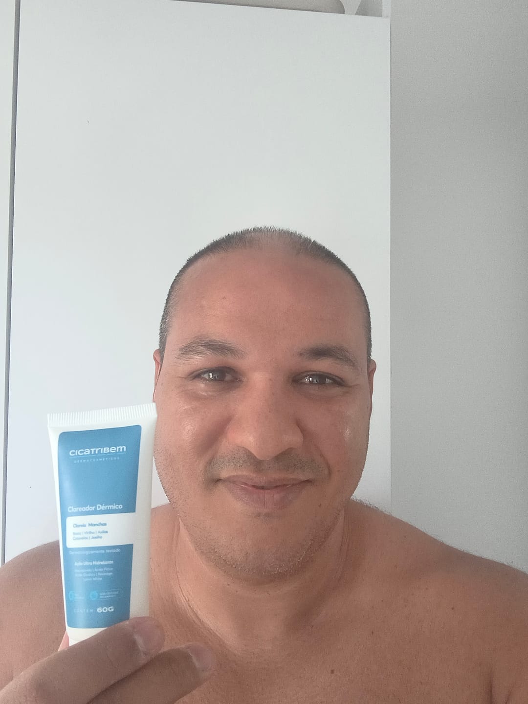 Customer photo review of Creme Clareador de Manchas – Melasma, Axilas, Virilha, Áreas Íntimas, Rosto e Corpo