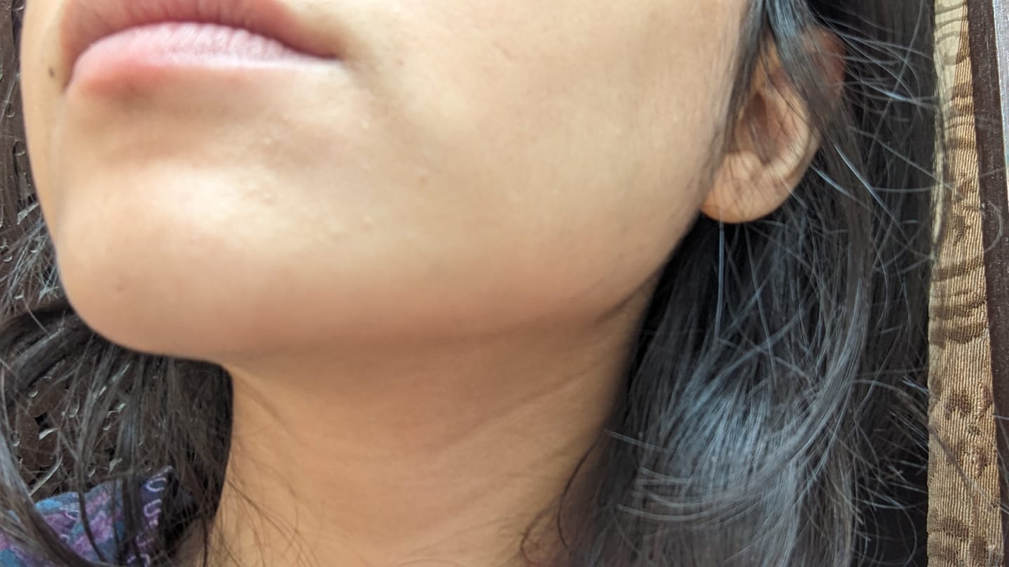 Customer photo review of Rice Extract Facewash