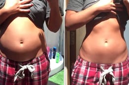 Customer photo review of DRAINANT LYMPHATIQUE LYMÉVIA®