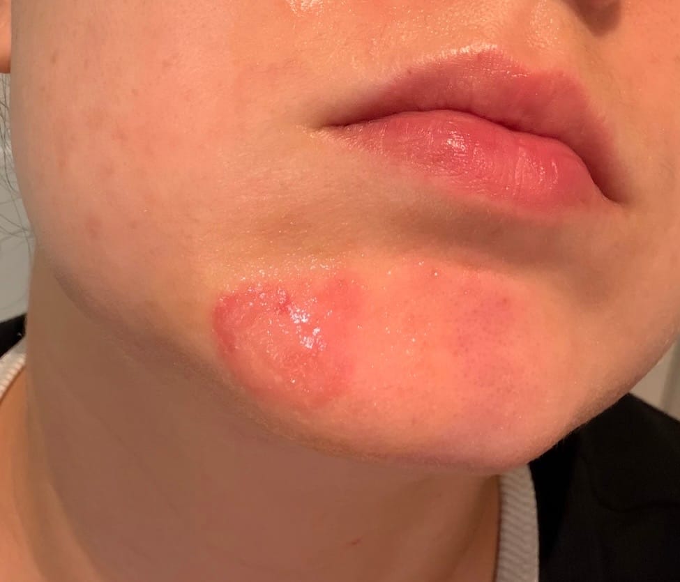 Customer photo review of Ringblomstsalve