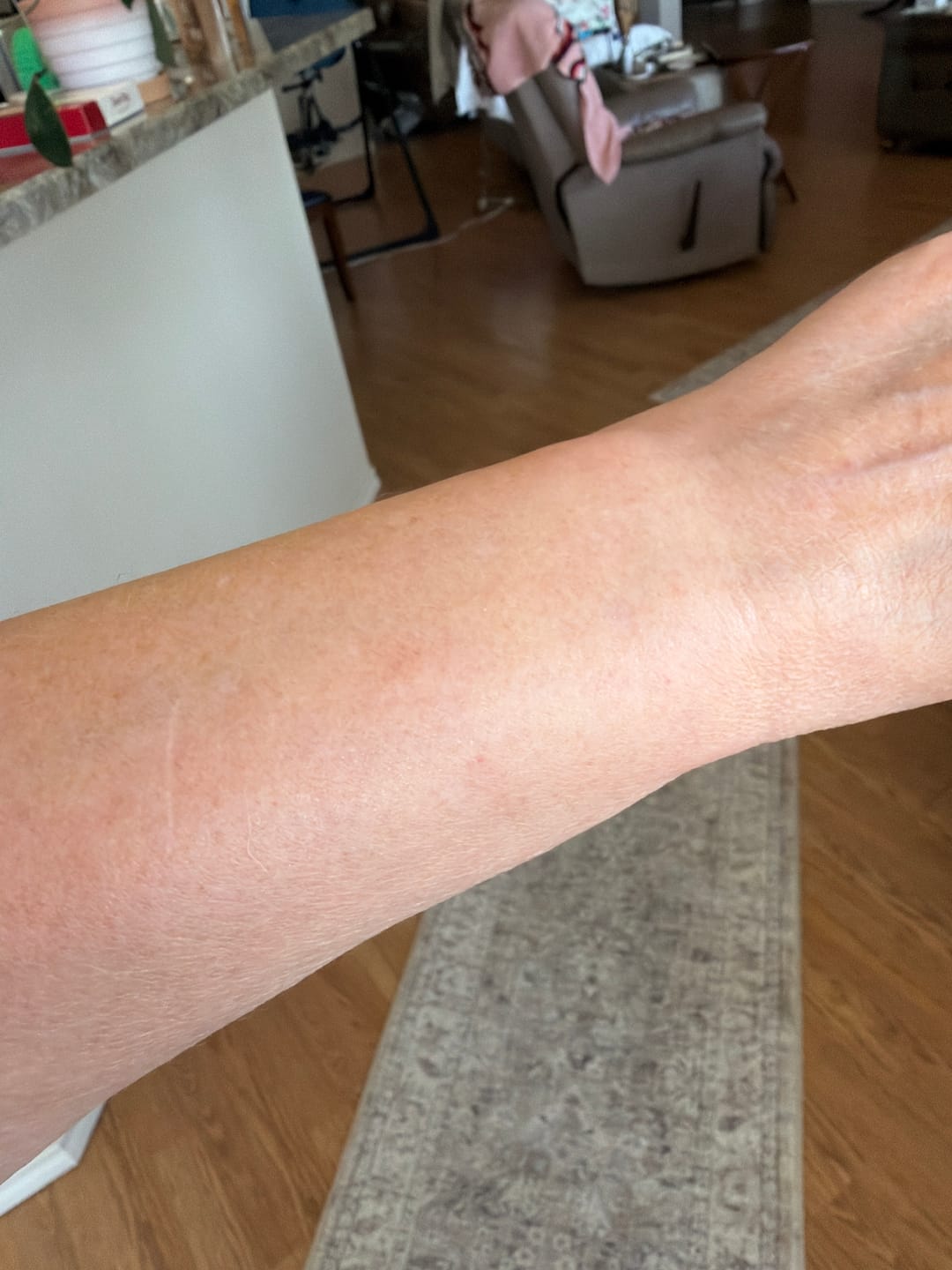 Customer photo review of Body Serum