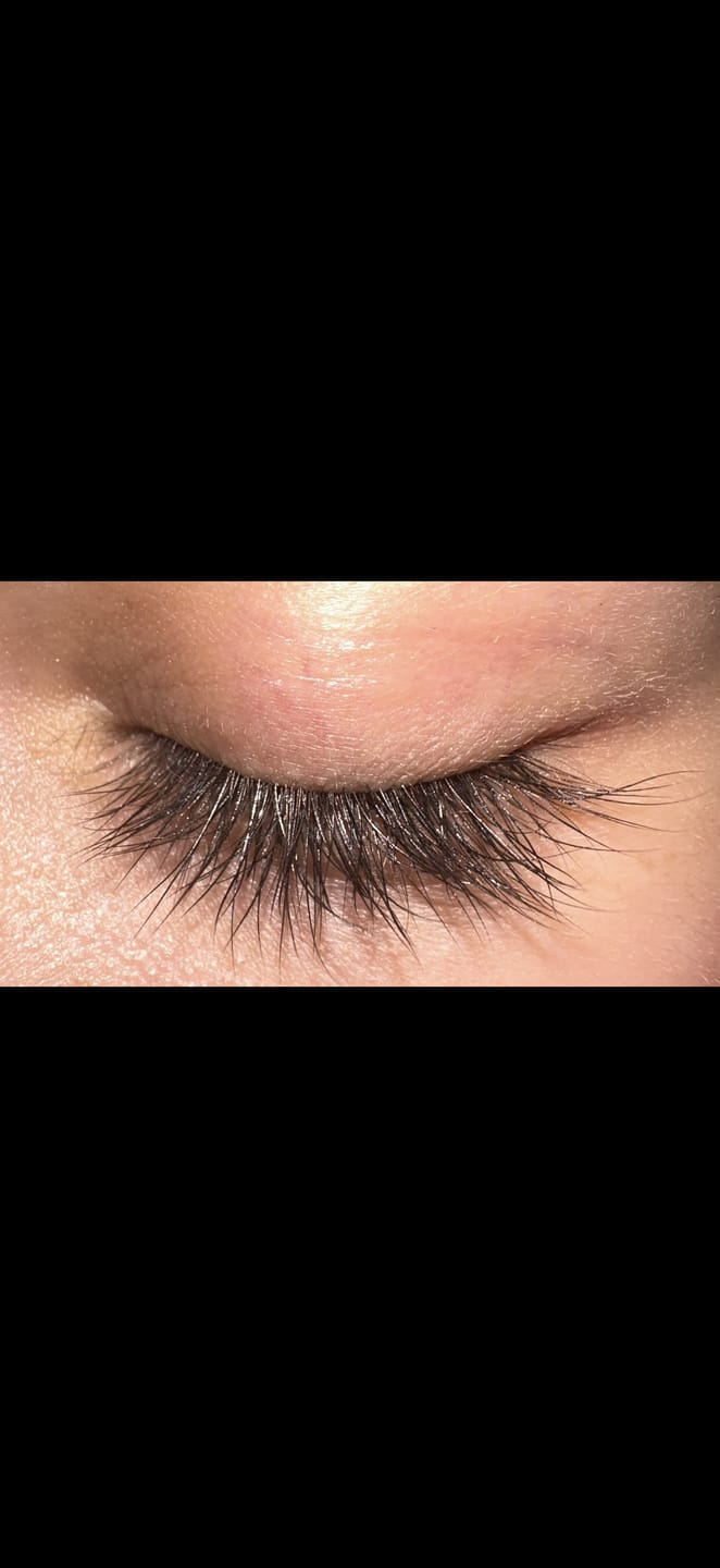 Customer photo review of LASH GROWTH SERUM
