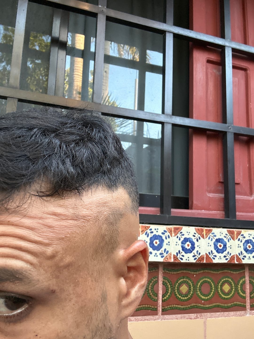 Customer photo review of Minoxidil 2.5 mg con 90 tabletas para 3 meses de tratamiento