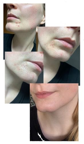 Customer photo review of Reine Haut Routine