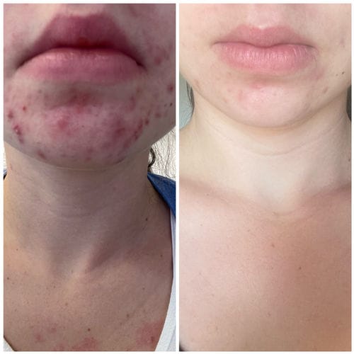 Customer photo review of Reine Haut Routine