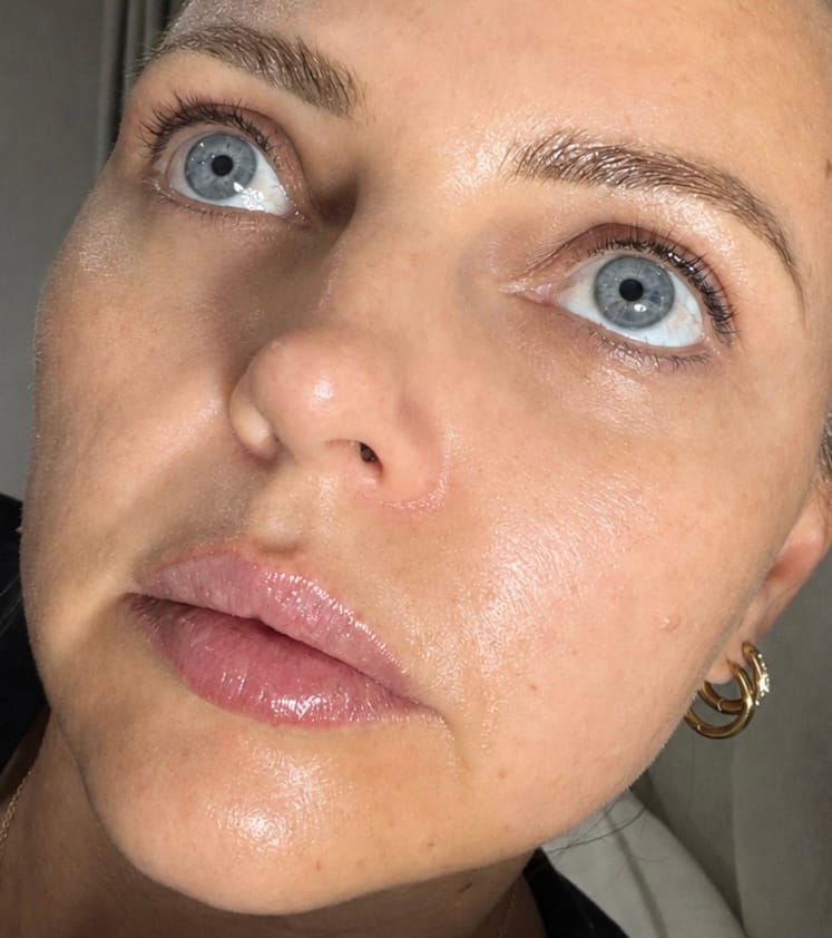 Customer photo review of The Super Glo Hydro Boost Jelly Moisturiser
