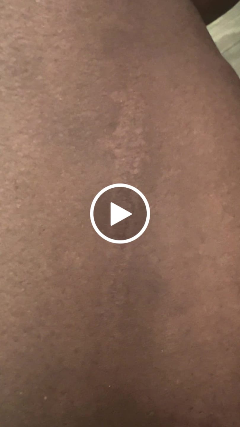 Customer video review of Shimma™ Black Seed Oil Body Coverage Perfector