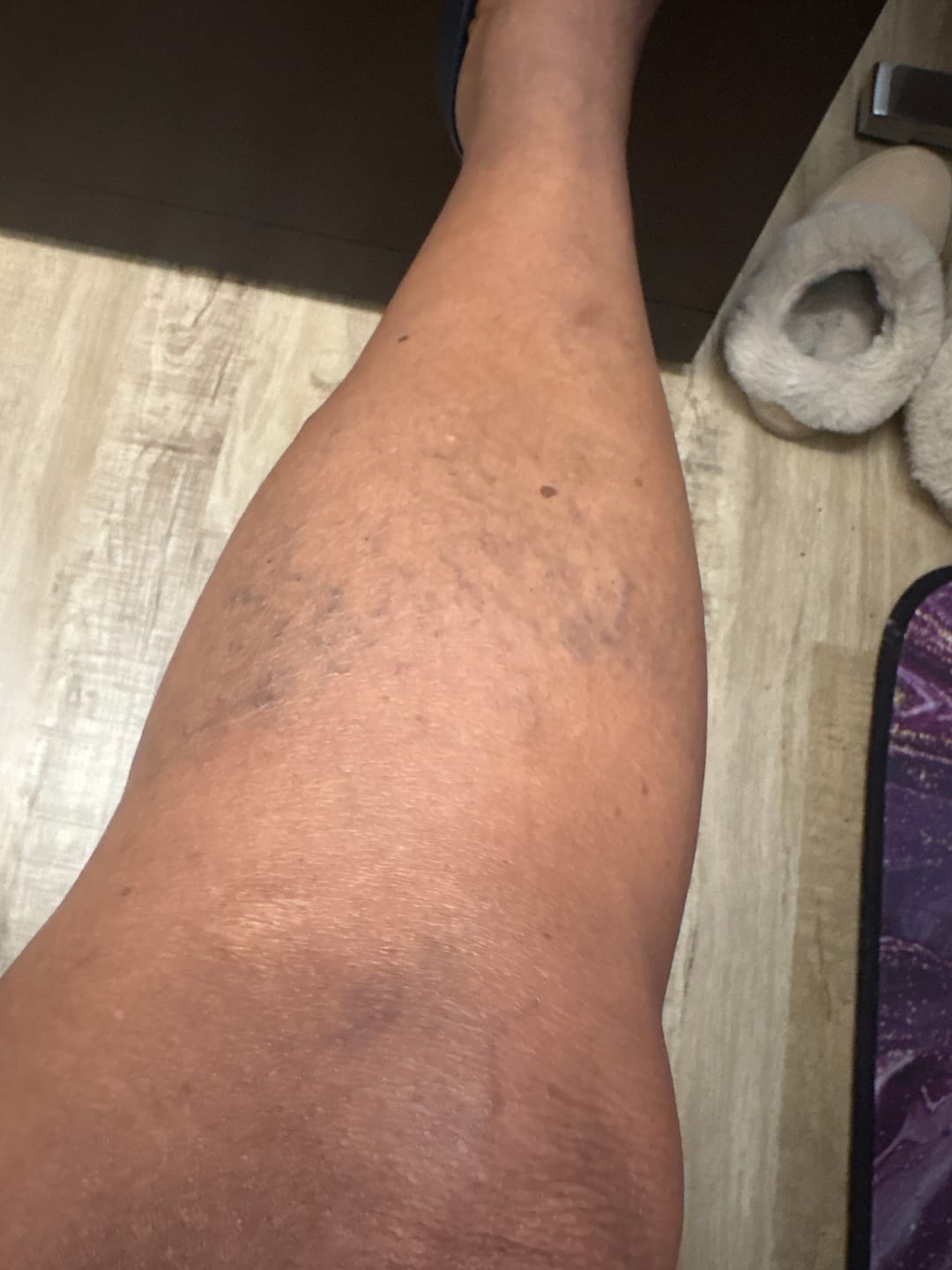 Customer photo review of Shimma™ Black Seed Oil Body Coverage Perfector