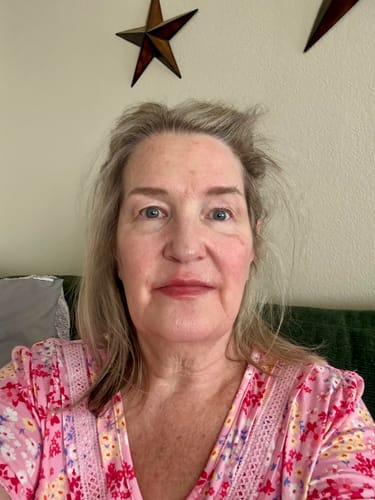 Customer's face immediately after using the Micro Infusion System, showing subtle redness.
