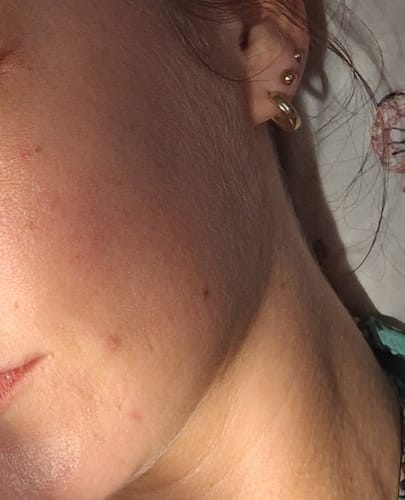 Customer photo review of Reine Haut Routine