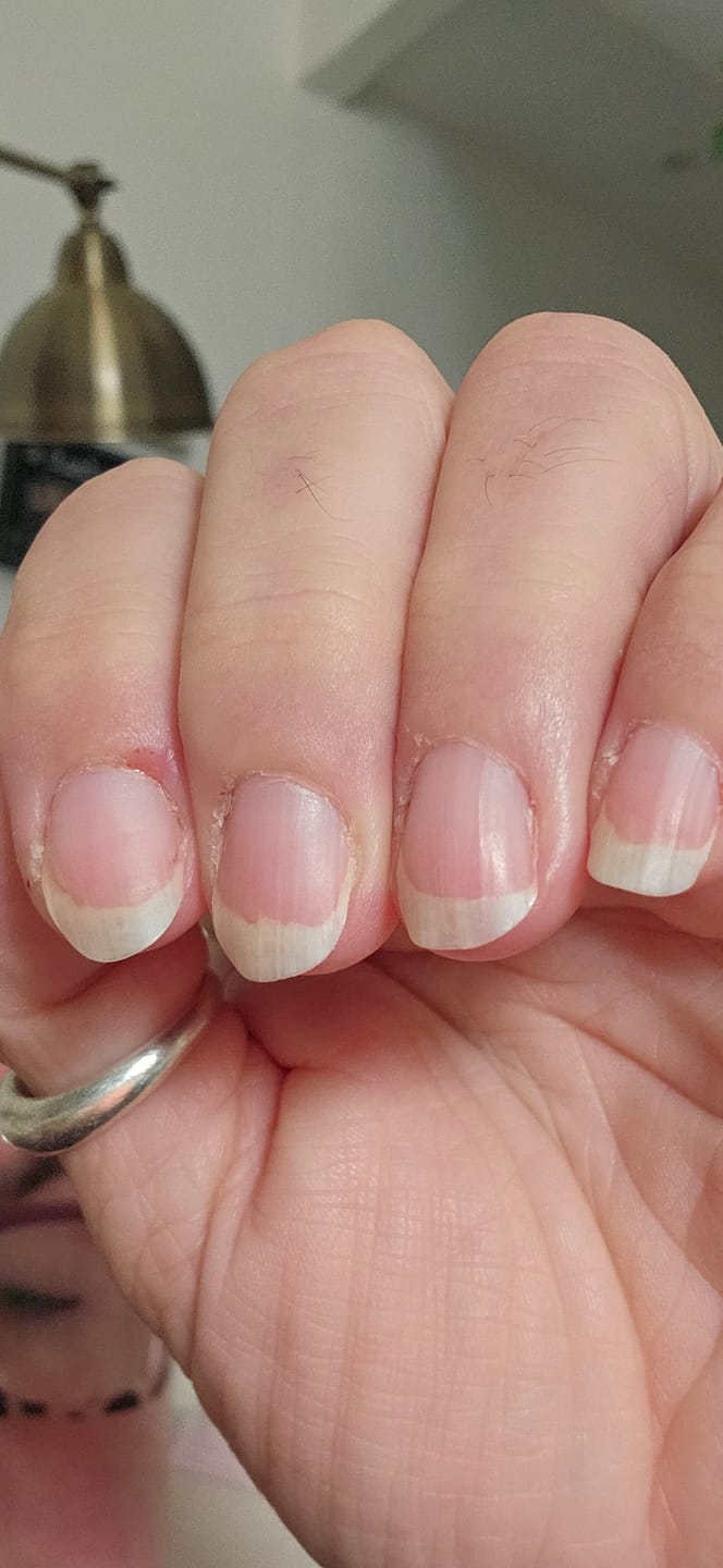 Customer photo review of 30 Days Of Age Defying Multi-Collagen
