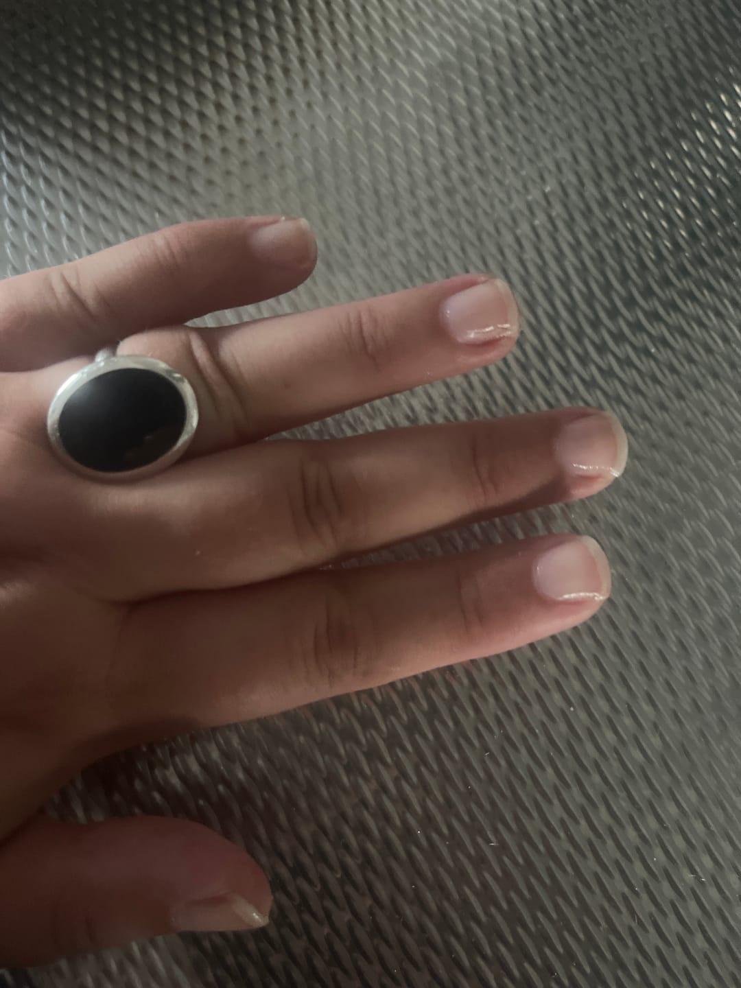 Customer photo review of Glowdip Alles-in-één Manicure Set