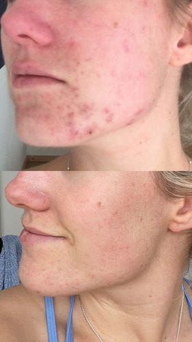 Customer photo review of Reine Haut Routine