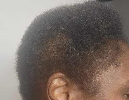 Customer photo review of Batana Basics: Grow, moisturize, condition, Hydrate and seal| Sunsplash + Bare Batana | 2 sizes